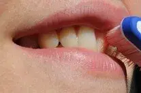 duke larë dhëmbët